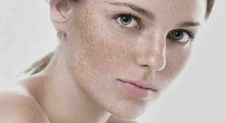 Jhaiyo Ki Best Cream – Freckles Removal Cream